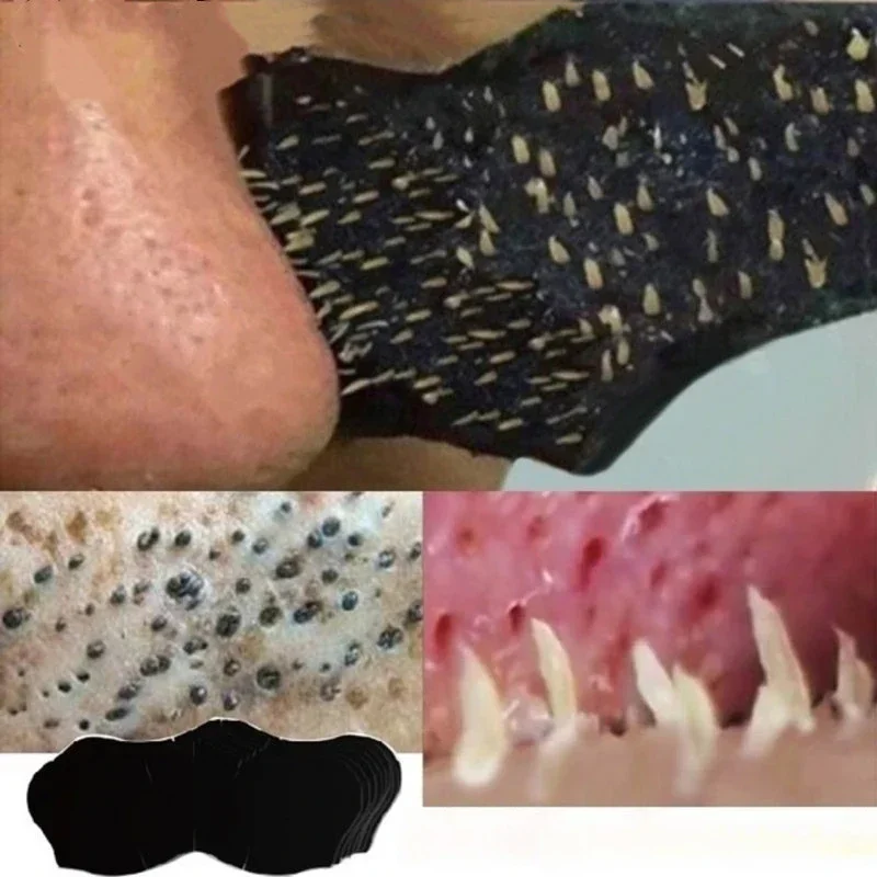Skincare Viral Tiktok - 10 قطع/50 قطعة 100 قطعة رقعة