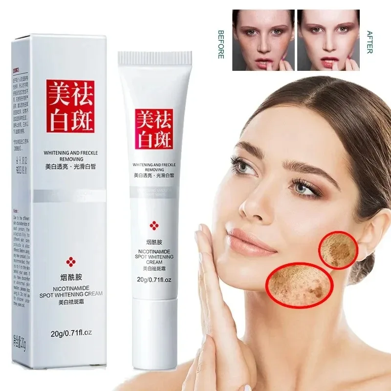Skincare Niacinamide - يتلاشى النمش البقع الداكنة كريم وجه
