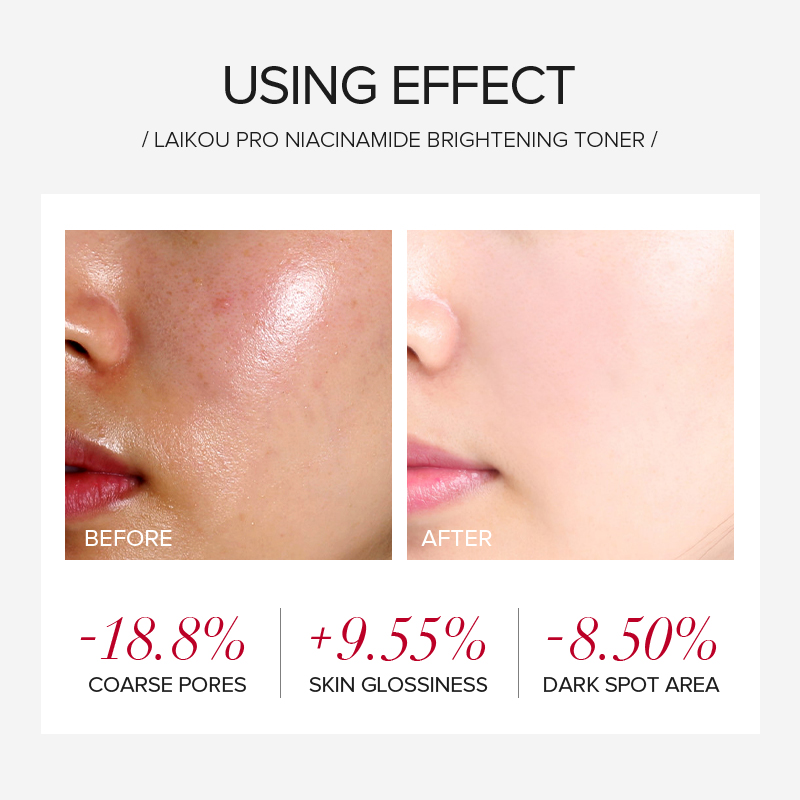 مجموعة العناية بالبشرة المبيضة - مراجعة Skincare Niacinamide وسعره