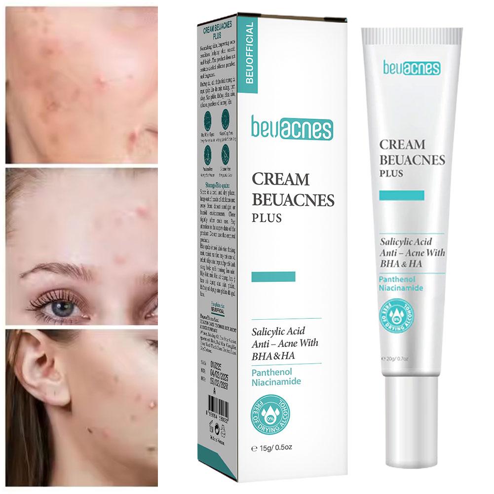 جديد 20 جرام نياسيناميد حب الش - مراجعة Skincare Niacinamide وسعره