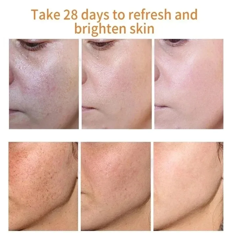 يتلاشى النمش البقع الداكنة كري - مراجعة Skincare Niacinamide وسعره