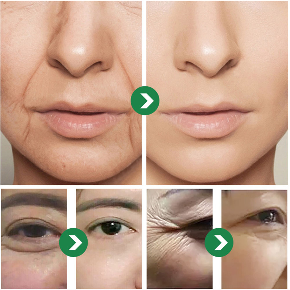 كريم ياباني بستة ببتيدات 50 جر - مراجعة Eye Cream Peptide وسعره